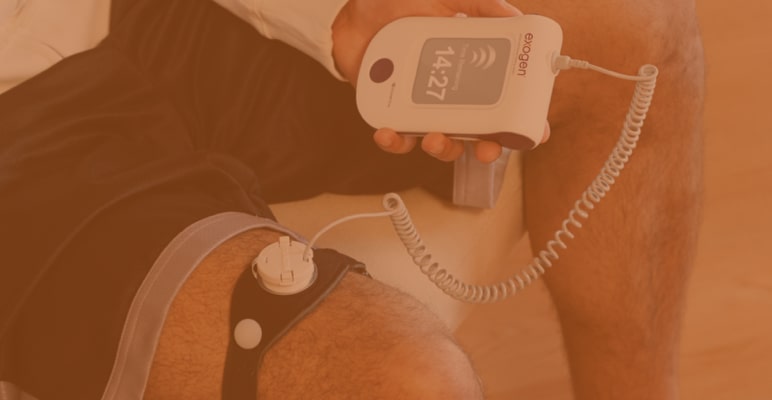 Exogen Bone Stimulator, The Knee Clinic